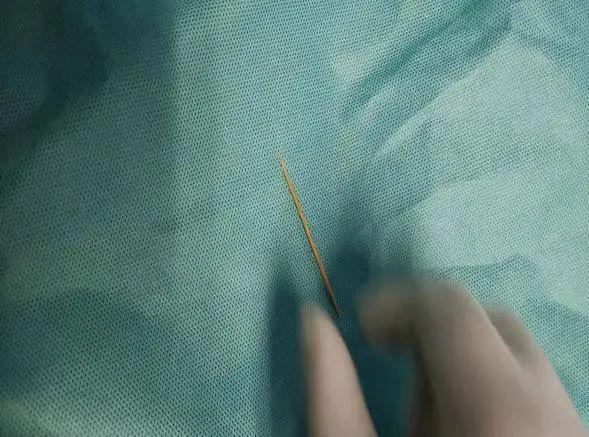 牙签|长沙小伙含着牙签喝水，一不小心吞进肚里致胃穿孔