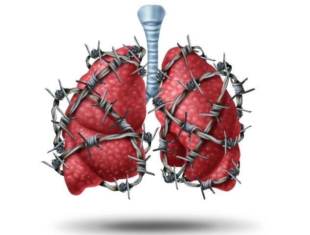 肺癌“偏爱”这4类人，若你符合，需注意加强养护肺脏，定期检查