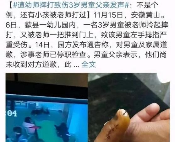 得知孩子被虐待，宝爸怒打幼师，园方袒护老师不道歉不让报警