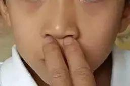「你的育儿经」孩子鼻炎犯了，总是鼻塞，怎么办？