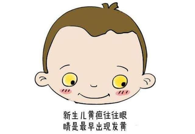超级宝妈:生理性,还是病理性,面对新生儿黄疸宝妈该咋办