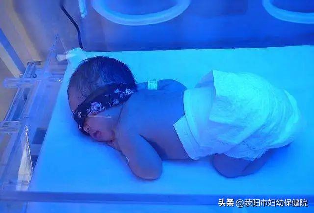 你的育儿经|揭开新生儿黄色迷雾