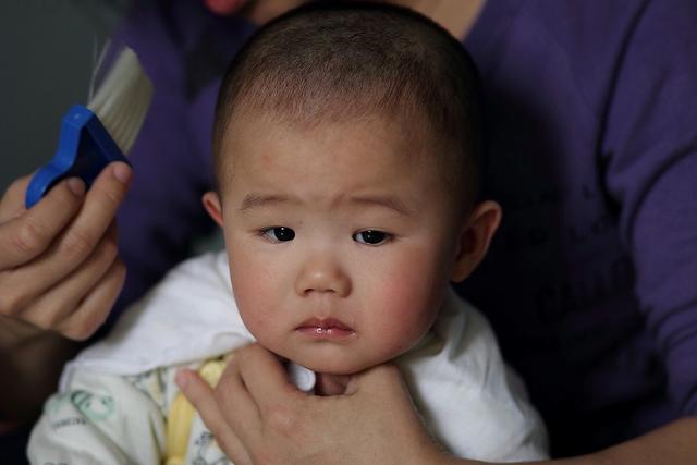 你的育儿经■孩子被烫伤后，应该先脱衣服吗？这个答案家长一定要提前知道