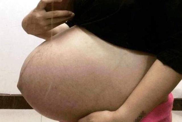 星星点灯|妻子头胎孕检被“误诊”为第二胎，丈夫脸发绿，医生忙道歉