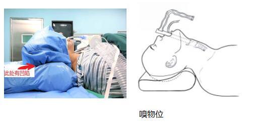 声带长息肉，江苏省中西医结合医院专家大胆创新解决棘手难题