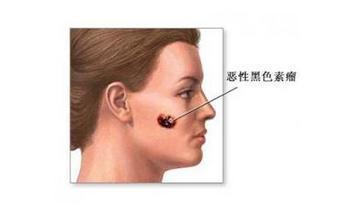 皮肤|带您了解皮肤肿瘤