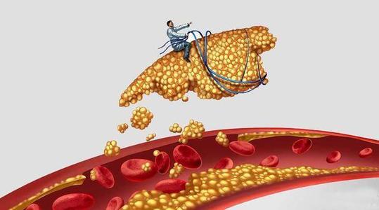 甘油三酯高，医生却说不用治疗，怎么回事？医生讲解，3种情况