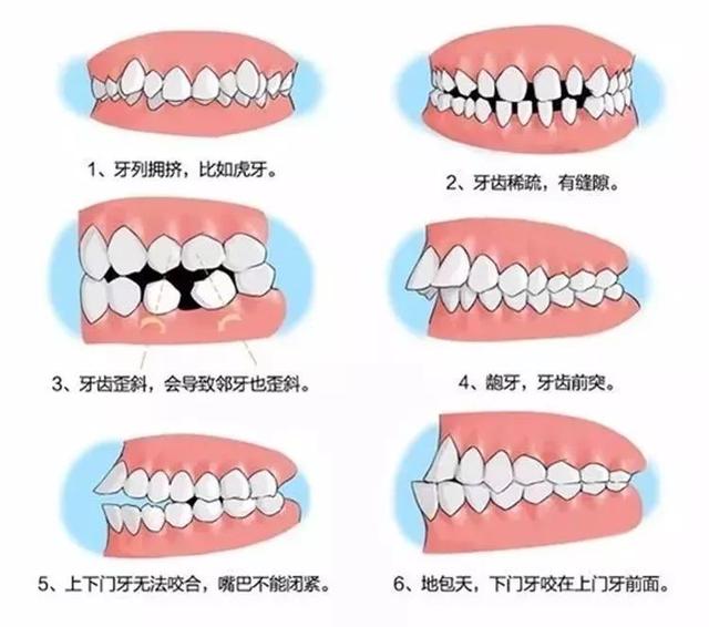 你的育儿经▲孩子换牙可不是小事，这些问题必须注意