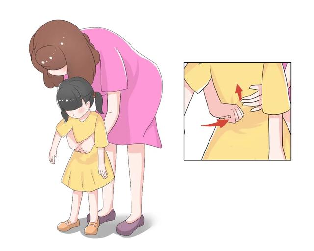 超级宝妈@孩子误食异物怎么办？知道这些关键时刻能救命