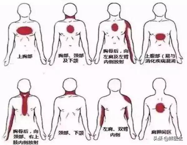 冠心病是如何被确诊的？看完这篇你就知道了