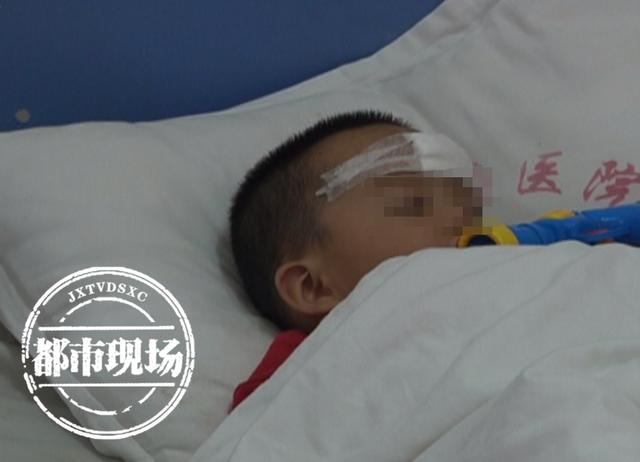 幸福的灯火|2岁孩子争抢玩具 零件不慎插进颅内3厘米 医生：千万不能自己拔
