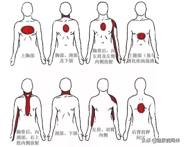 冬季，糖尿病人严防此高发性致命并发症