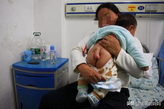 「超级宝妈」6个月宝宝长出“小尾巴”，宝妈悔不当初：早知道孕期不那样做了