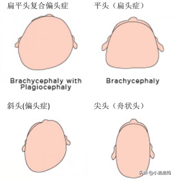 「你的育儿经」照顾新生儿，别什么都听老人的，别因这些误区伤害到宝宝健康