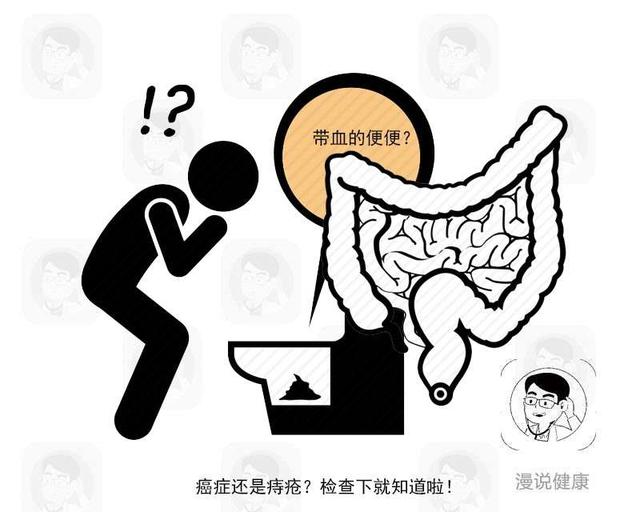 用这种方式来“行事”，小心招来肛门癌！这类群体更得做好2件事