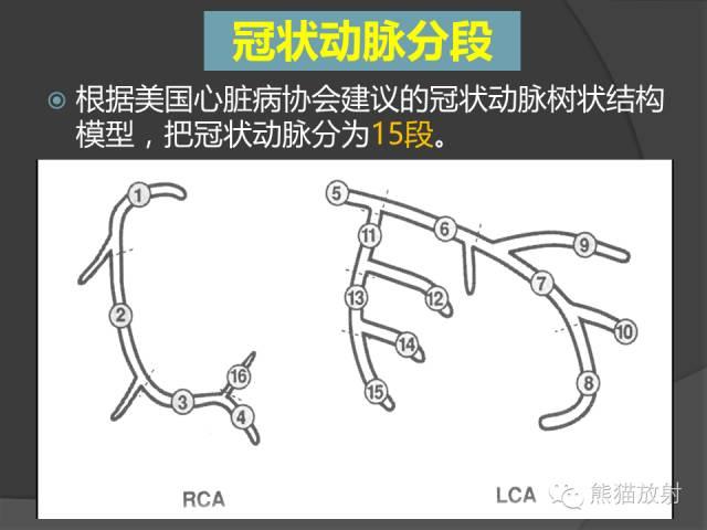 冠状动脉系统解剖、CTA解剖、分段及中英文名称对照