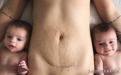 你的育儿经■这才是女人生完孩子的真实状态,致敬妈妈们,继续美丽的方法在这