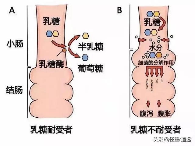「超级宝妈」宝宝普遍缺乏乳糖酶？乳糖不耐受的宝宝需要长期吃？