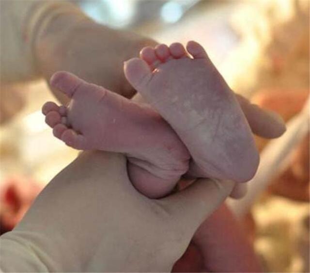 你的育儿经|新生儿裹着“奶油”出生，爸爸看后焦急大哭，医生却说恭喜