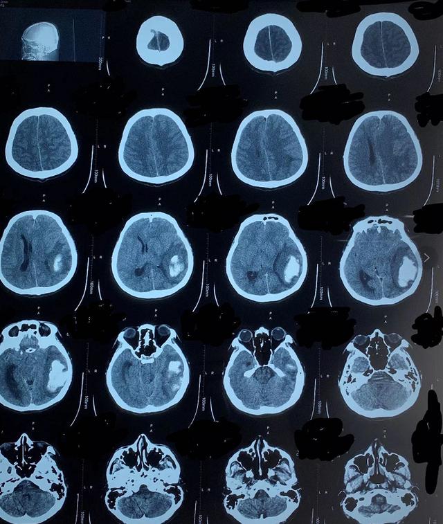 患者|中国援几医疗队：“奋战”近一个月，救回病危男子