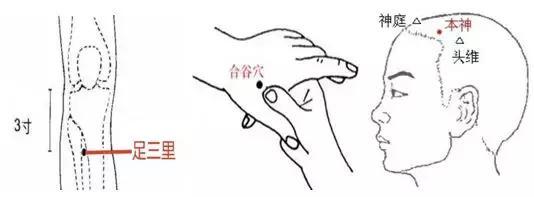 脱发、白发的中医调养方案，快试试吧