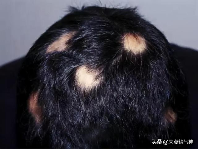 头发的问题全在这里！保持头发的健康，要做到以下四点