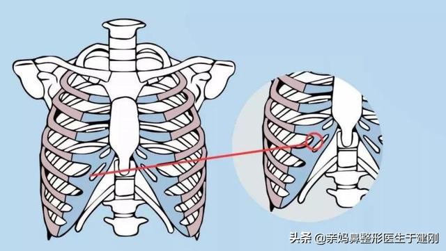 崩溃！耳软骨被吸收，经修复取出发现薄如蝉翼，怪不得鼻子塌了