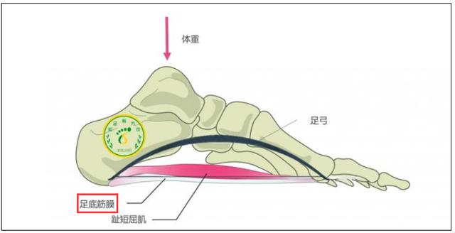 有种脚痛叫「足底筋膜炎」！不花冤枉钱，医生教您真正有用的方法