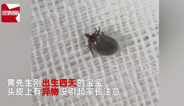 发现|惊险！出生仅4天婴儿被蜱虫咬伤，父亲：发现时头全部吸进去了