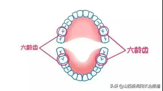 超级宝妈|长兴口腔六一儿童节福利，快带孩子来免费做窝沟封闭吧