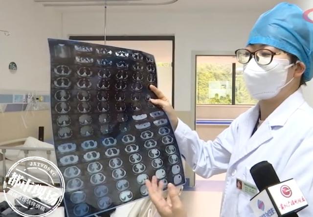 小娅|10岁女童咳嗽1年多，以为是肺结核，后来发现和玩具有关
