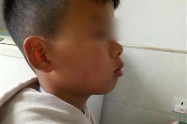 超级宝妈■挺可爱的孩子结果越长越丑，甚至像“猩猩”？检查之后宝妈后悔了
