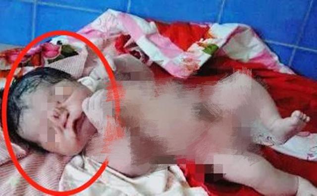 [你的育儿经]高龄孕妈生下“猪八戒”宝宝，丈夫无法接受，医生解释让家人放心