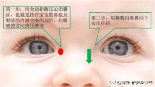 甜蜜妈妈|宝宝总是眼泪汪汪，还有眼屎，是上火了吗？