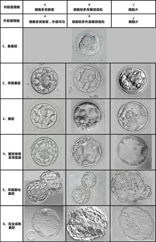 谈天说地|你真的会看囊胚级别吗？