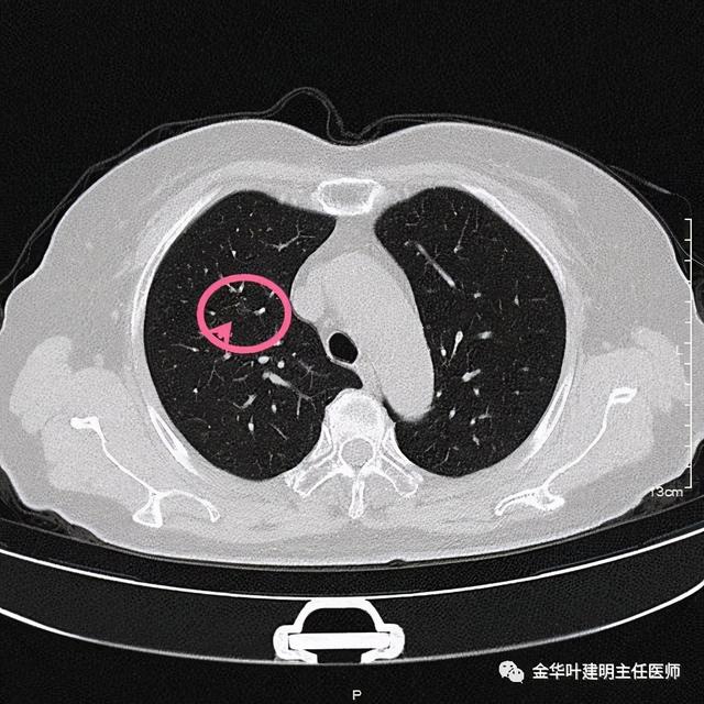 如此违反原则的手术方案设计，你支持吗？
