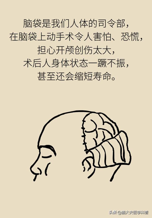 开颅手术就是“打开人的天灵盖”？我怀疑你是个古代人