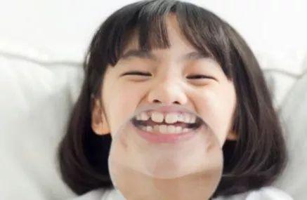 #你的育儿经#牙齿不齐的缘由（一）——遗传因素