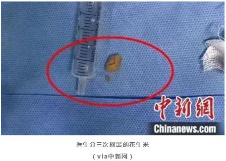 超级宝妈▲2岁宝宝吃花生米被呛，险被家长奇葩操作害死黄金5分钟该怎么急救