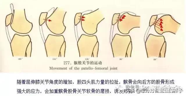 内侧半月板|为什么走平路膝关节不疼，但是打弯、下楼梯、蹲起时膝关节疼痛呢