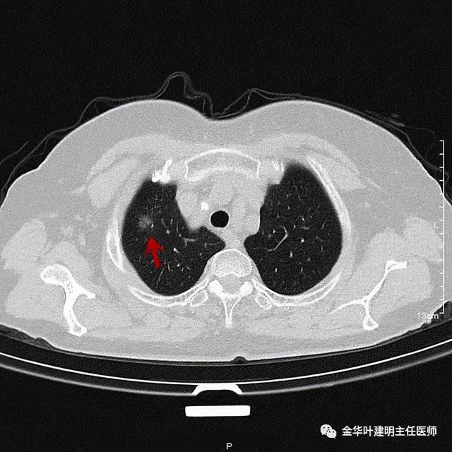 如此违反原则的手术方案设计，你支持吗？