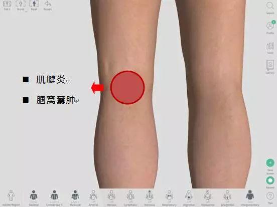 我的膝盖怎么了？——膝关节不同部位疼痛的原因