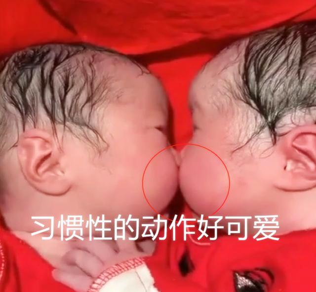[你的育儿经]兄妹刚出生就一直亲，护士都分不开，这一幕实在太暖心了