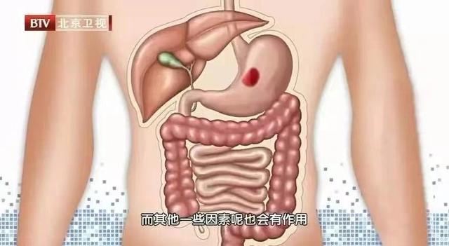 激素|伤害甲状腺的“危险分子”，第一个你就想不到！抓住三个小细节，悄悄保护甲状腺