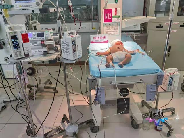 宝宝|惊心动魄！扬州一“熊猫血”新生儿患溶血症，必须全身换血才有生机……