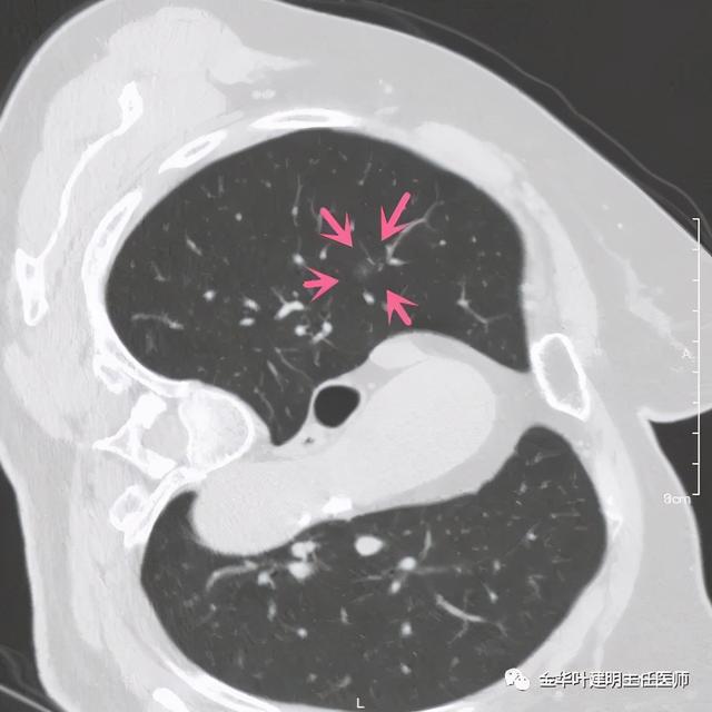 如此违反原则的手术方案设计，你支持吗？
