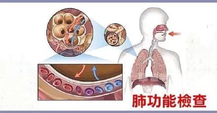 功能|什么是肺功能检查？