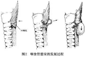 戴口罩有股臭味，究竟是口罩臭还是口臭？