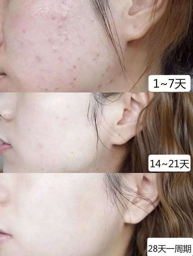 你的育儿经▲应采儿不愧是“最正辣妈”，孕期素颜嫩如水，自曝孕期保养秘籍
