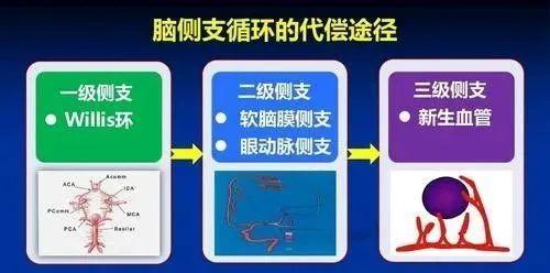 脑内的Willis环，你知道吗？